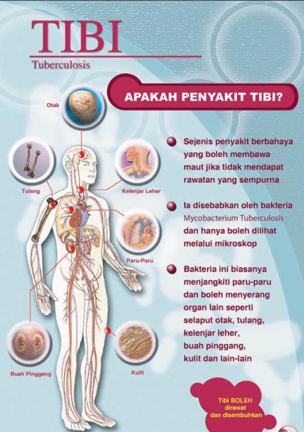 Penyakit Tibi Tulang - Homecare24