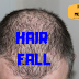 Hair Fall - Reasons, Causes, Symptoms & Treatment