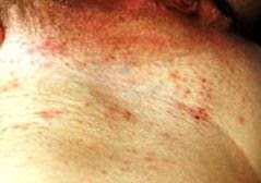 Do not forget that there might be elderly removing facial hair for women tips people in your how to shave and youths, and jokes must be appropriate for most members of your crowd. How to shave your underarms.