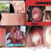 Obat Sipilis Kencing Nanah Herbal De Nature thumbnail