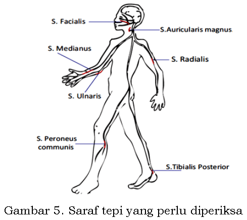 144 PENYAKIT LEPRA KUSTA 144 PENYAKIT LEPRA KUSTA