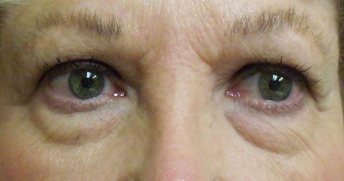 Facial Exercises To Look Younger What About These Facial