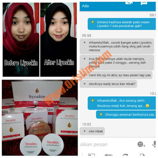 Cream Penghilang Komedo Dan Flek Hitam Liyoskin Cream Penghilang Komedo Dan Flek Hitam