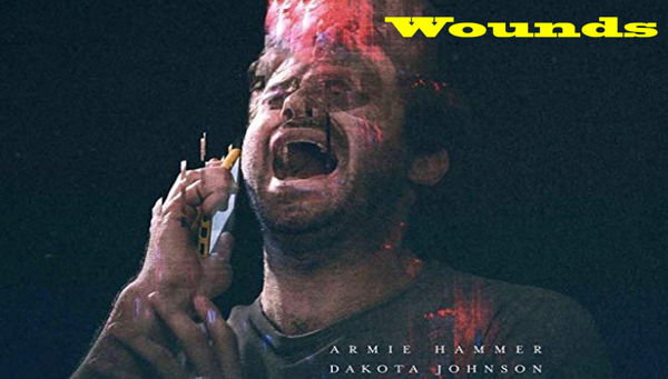 Wounds