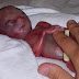 Des adolescentes enceintes font une horrible choses pour garder leur bébé le plus petit possible.