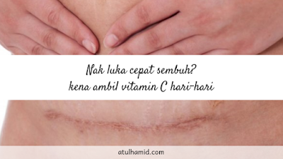 Fungsi Vitamin C Untuk Badan