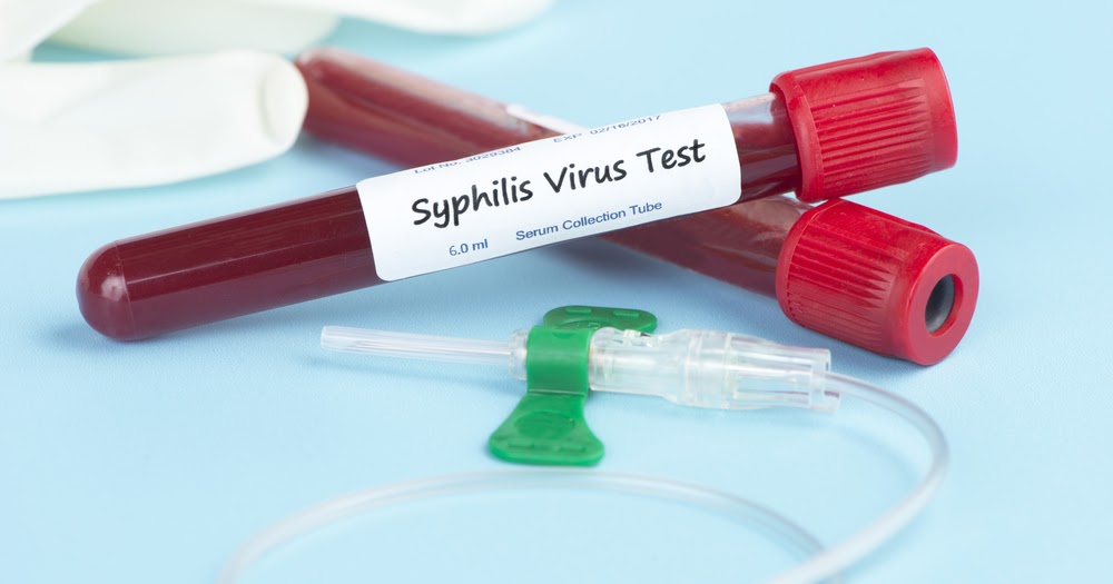 Rapid STD Testing Syphilis Testing Why is it important?