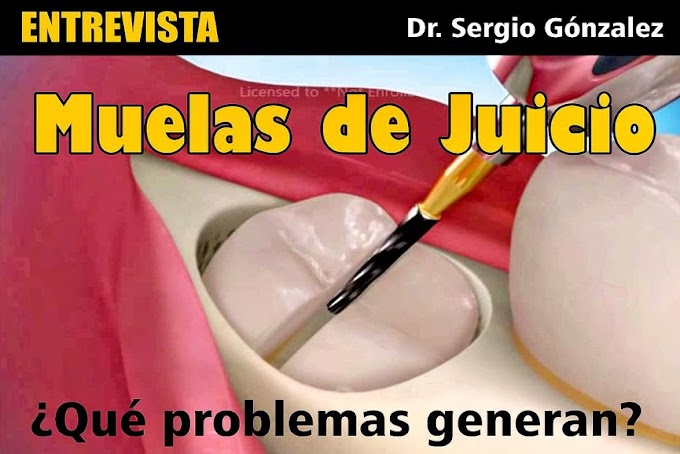 'MUELAS DE JUICIO': ¿Qué problemas generan? - Dr. Sergio Gónzalez