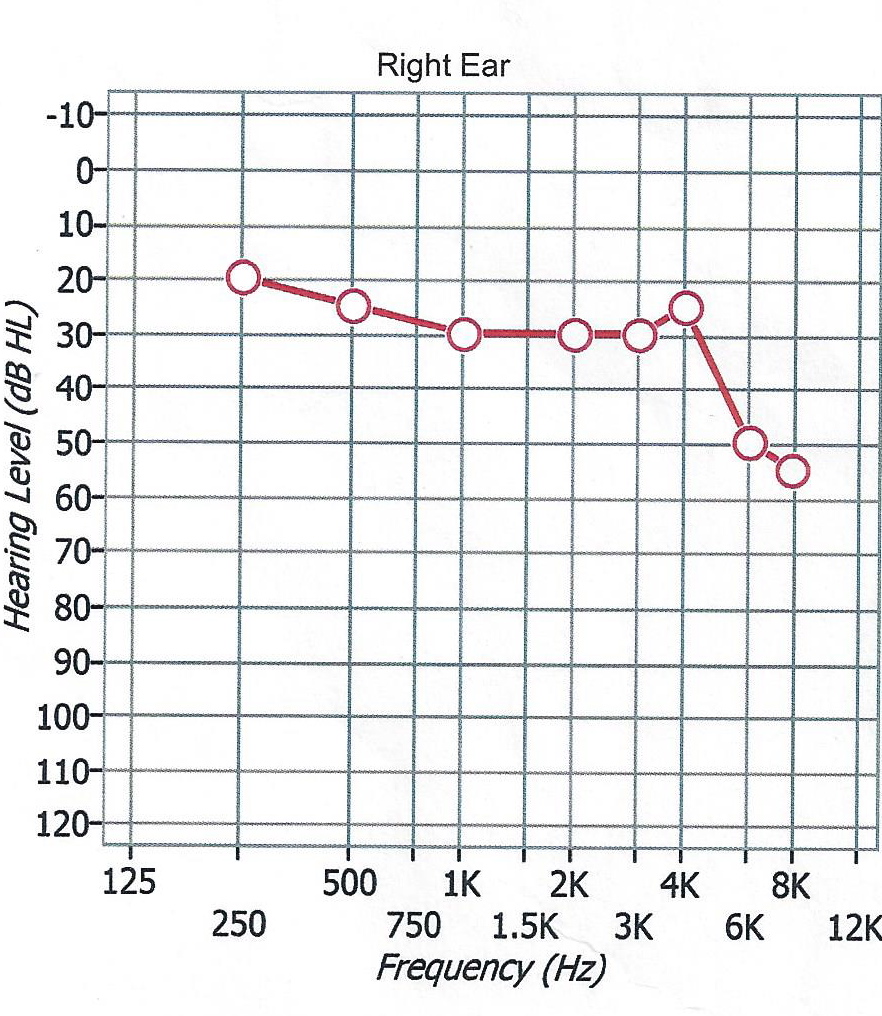 Views by the Bay Hearing Footsteps