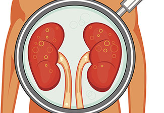 My Family Medicine Practice: Introduction To Analgesic Nephropathy