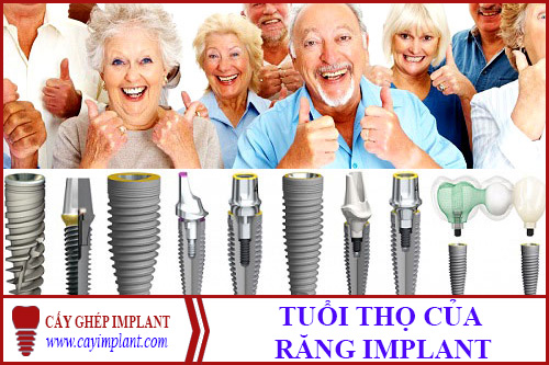 TUỔI THỌ CỦA RĂNG IMPLANT