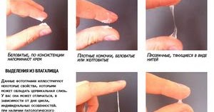 White vaginal discharge during sex pic 52