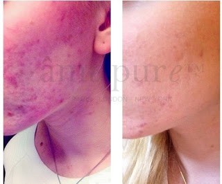 cit face roller review