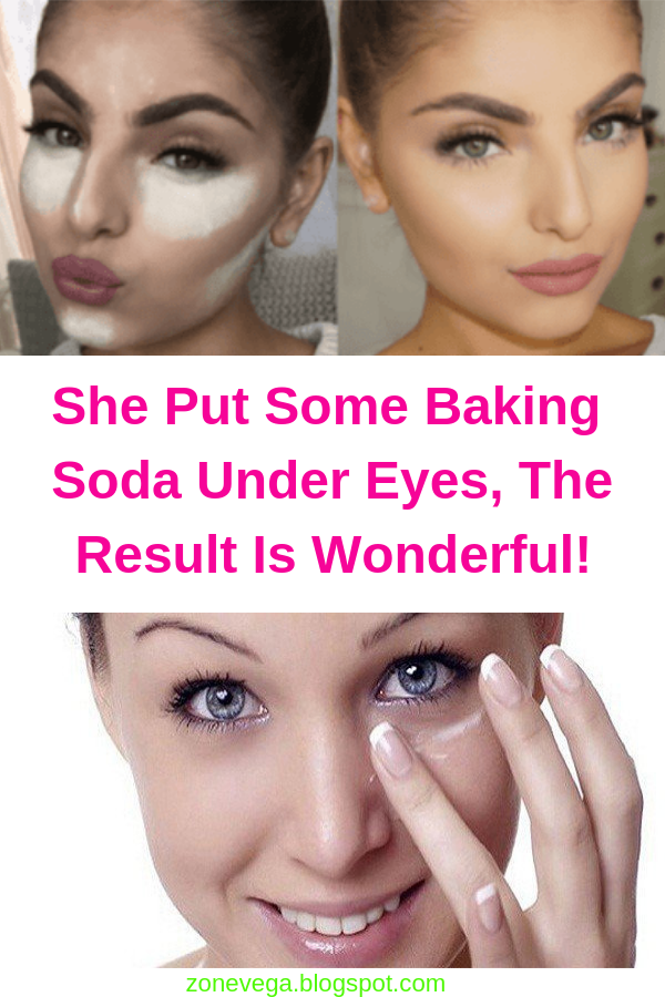 She Put Some Baking Soda Under Eyes, The Result Is Wonderful! Health