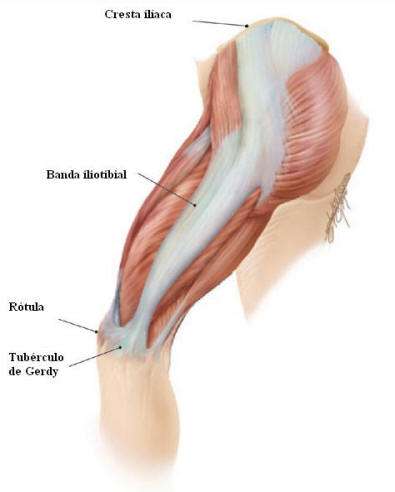 dolor en musculo tensor de la fascia lata