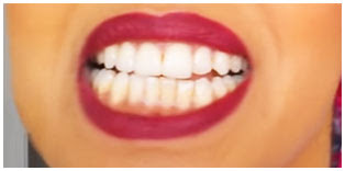 como disimular los dientes amarillos