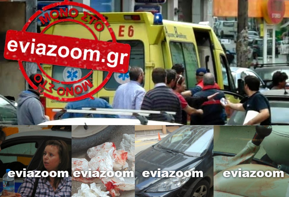 Φρικτό ατύχημα στη Χαλκίδα: Λεωφορείο έκοψε τα δάχτυλα 27χρονης οδηγού που έβγαινε από το αυτοκίνητο - Mαρτυρίες-σοκ στο eviazoom.gr (ΦΩΤΟ & ΒΙΝΤΕΟ)
