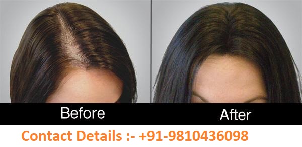 Digital Marketing Services In Gorakhpur Gkp Prp Laser