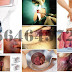 AmbeJOSS Buat Sakit Wasir alias Hemoroid thumbnail