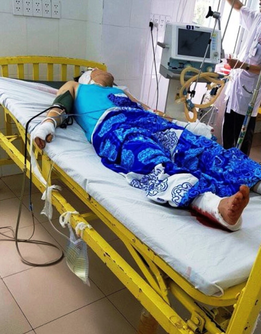 Gia Lai: Một thanh niên bị chém đến tàn phế, ngồi xe lăn... hơn 9 tháng nhóm côn đồ vẫn chưa bị bắt