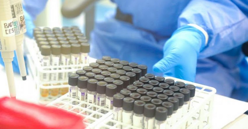 Mujer de 55 años años se convierte en el segundo caso positivo de Coronavirus en La Libertad Mujer de 55 años años se convierte en el segundo caso positivo de Coronavirus en La Libertad