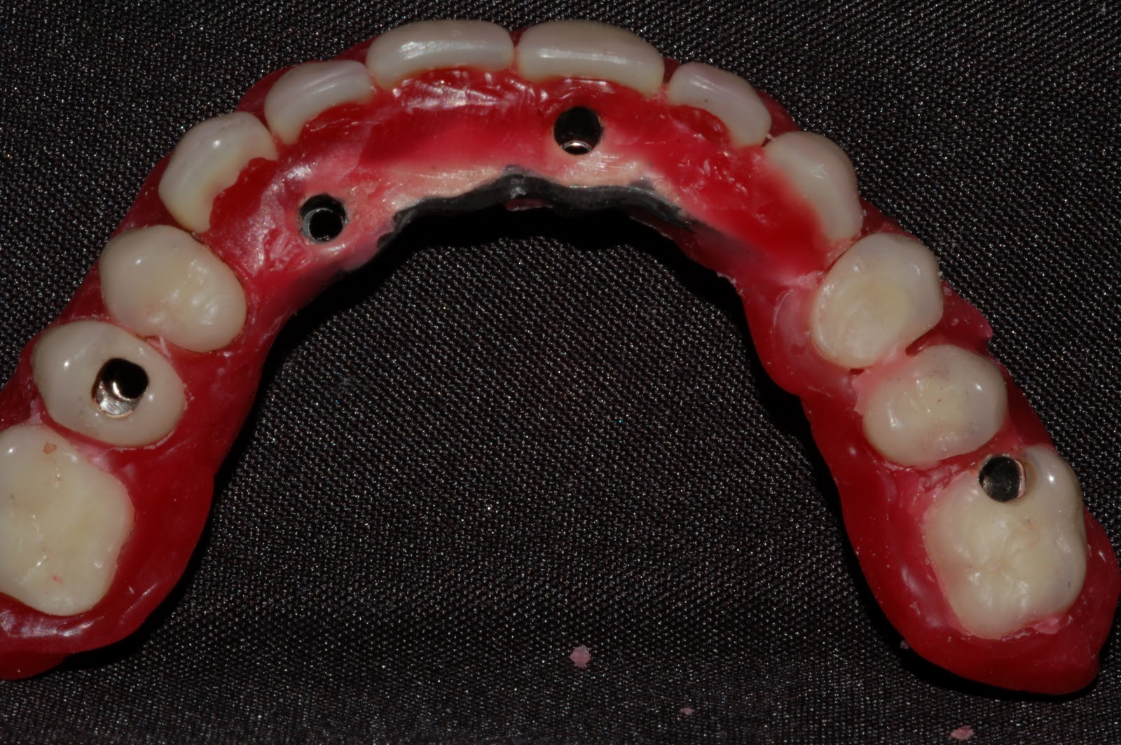 Stefano La Scala: Toronto Bridge