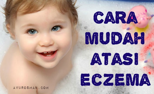 Bagaimana Untuk Mengenali Ekzema Pada Bayi Bagaimana Untuk Mengenali Ekzema Pada Bayi