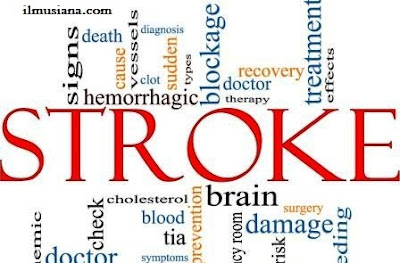Racun ini Ampuh Obati Stroke & Epilepsi