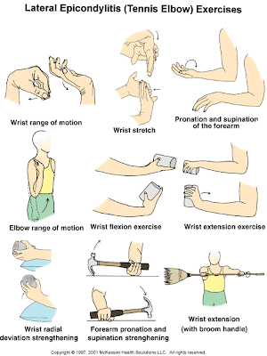 Exercises for tennis elbow | Article Villa