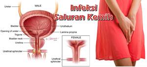 Obat Infeksi Saluran Kemih Resep Dokter