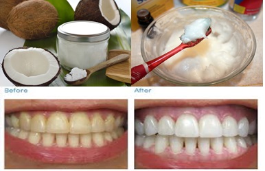 UNBELIEVABLE: This Oil Could Be More Effective Than Your Toothpaste! Find Out More Here! UNBELIEVABLE: This Oil Could Be More Effective Than Your Toothpaste! Find Out More Here!