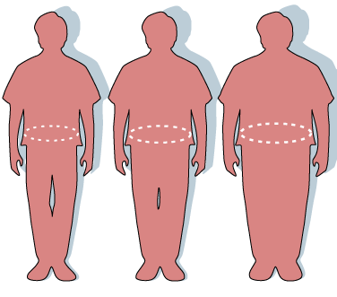 Top 10 mitos sobre la obesidad