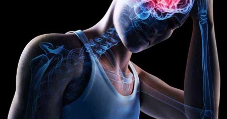 Lo que debes saber acerca de una conmoción cerebral