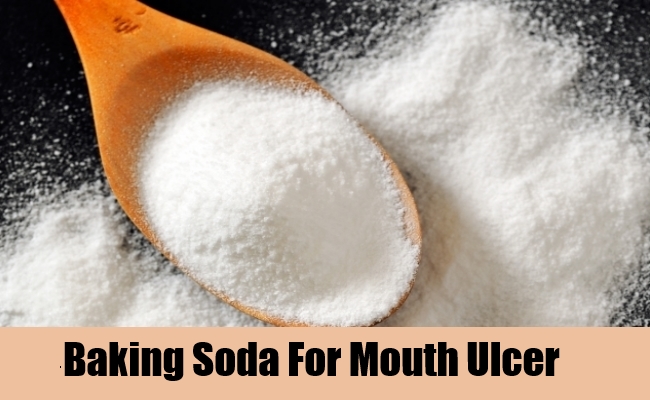 نتيجة بحث الصور عن ‪Effective natural ways treat mouth ulcers‬‏