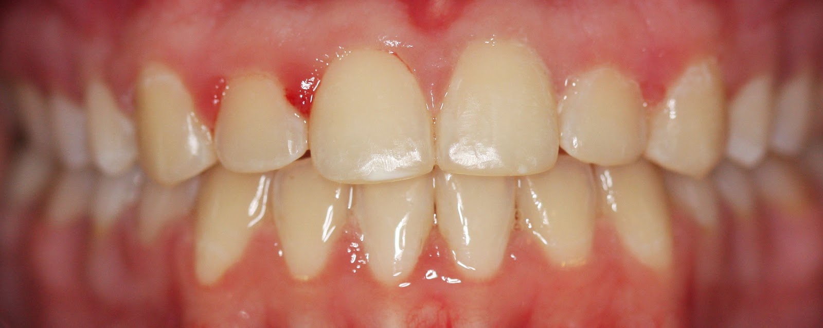 James R. Waters, DDS, MSD, PA Reshaping and polishing edges of teeth