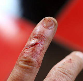 I sliced my finger open, and did more after this picture was taken I sliced my finger open, and did more after this picture was taken