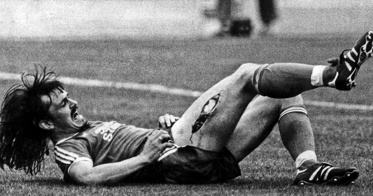 A contusão mais impressionante da história do futebol mas que nada A contusão mais impressionante da história do futebol mas que nada