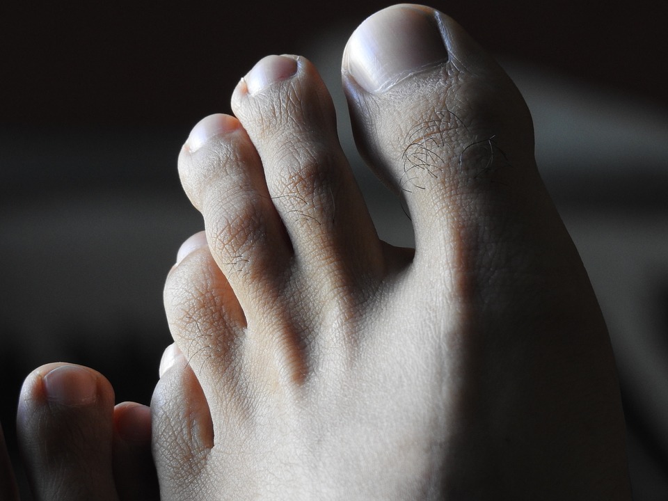 Symptoms of Toe Arthritis