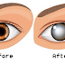 Frequent Use Of Smart Phone Before Bed Can Lead To Permanent Blindness
