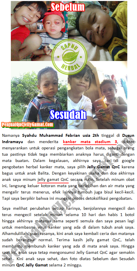 Cara Mengobati Kelopak Mata Bengkak Dan Gatal Secara Alami Terbukti Manjur ~ TESTIMONI QNC JELLY GAMAT Cara Mengobati Kelopak Mata Bengkak Dan Gatal Secara Alami Terbukti Manjur ~ TESTIMONI QNC JELLY GAMAT