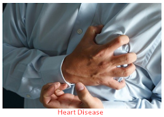 3 Ways to Treat Heart Disease Naturally : Heart Problems, Congestive Heart Failure