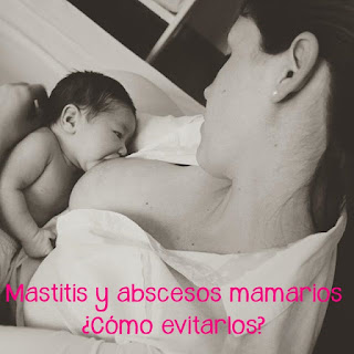 ¿Por qué me operaron de mastitis y cómo lo hubiera evitado"