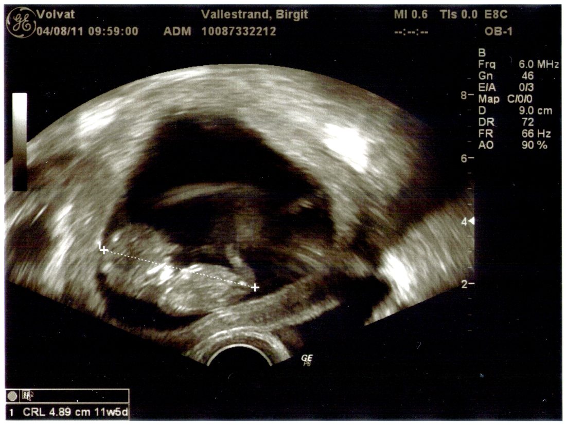 My Baby Bump Scans