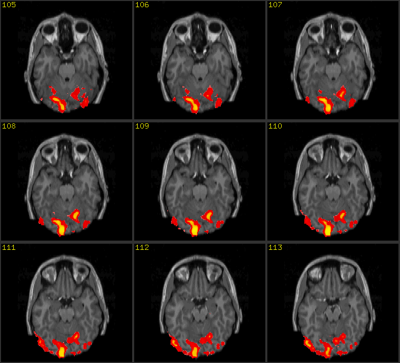 BIOMEDICAL FMRI biomedical-fmri