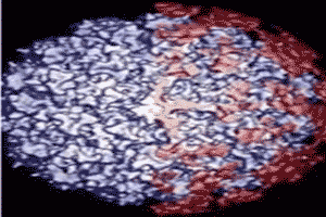 Imagen del virus del papiloma humano o VPH Imagen del virus del papiloma humano o VPH