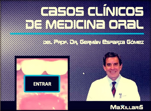 DVD INTERACTIVO: "Casos clínicos de Medicina Oral", del Prof. Dr. Germán Esparza Gómez
