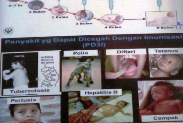 Penyakit yang Dapat Dicegah Dengan Imunisasi (PD3I)