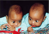 gambar Bayi Kembar