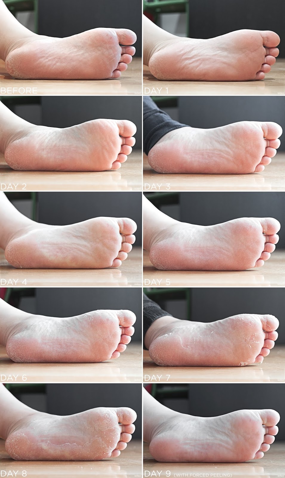 lavlilacs the SAEM Dear My Foot Power Peeling progression of peeling