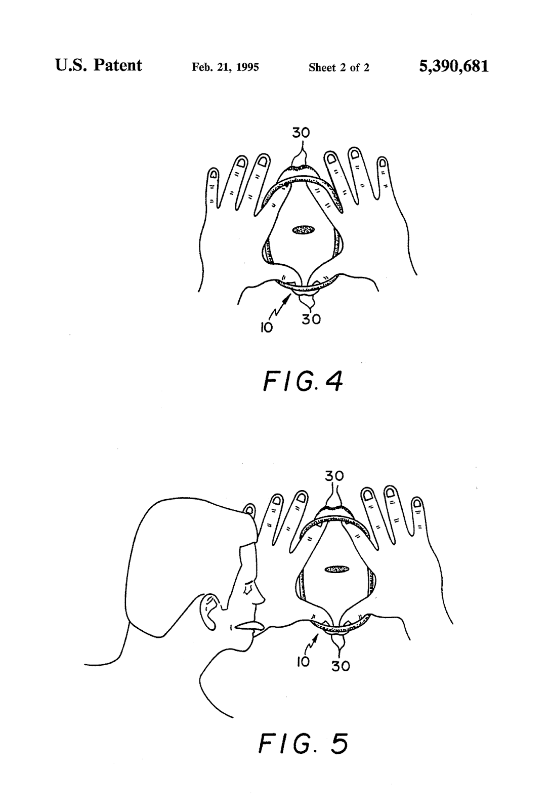 Dental dam urban definition